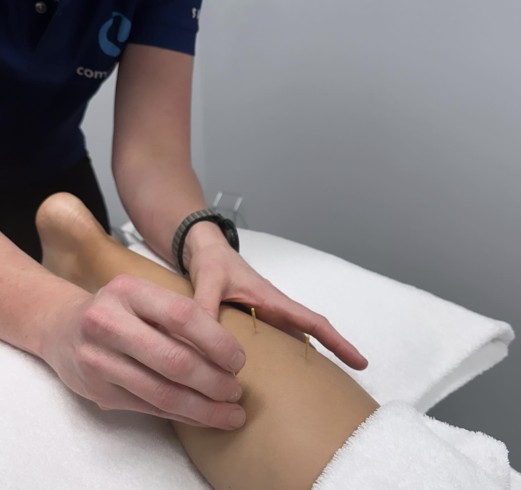 Dry needling involves using fine single use needles inserted into the muscles, taught bands of muscle and sometimes connective tissue to elicit a response.