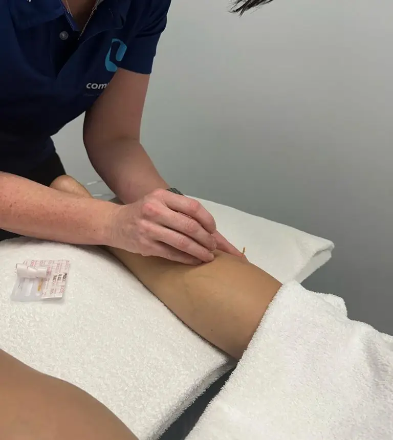 Dry needling treatment on a calf muscle at Complete Physio Richmond
