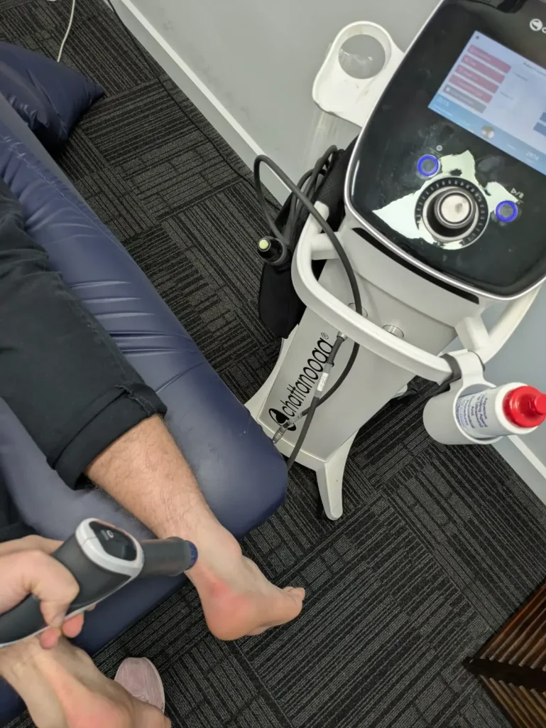 Close-up of a shockwave therapy applicator delivering acoustic waves to a patient's heel